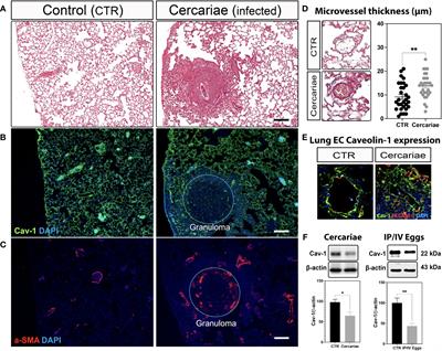 Schistosomiasis-associated pulmonary hypertension unveils disrupted murine gut–lung microbiome and reduced endoprotective Caveolin-1/BMPR2 expression